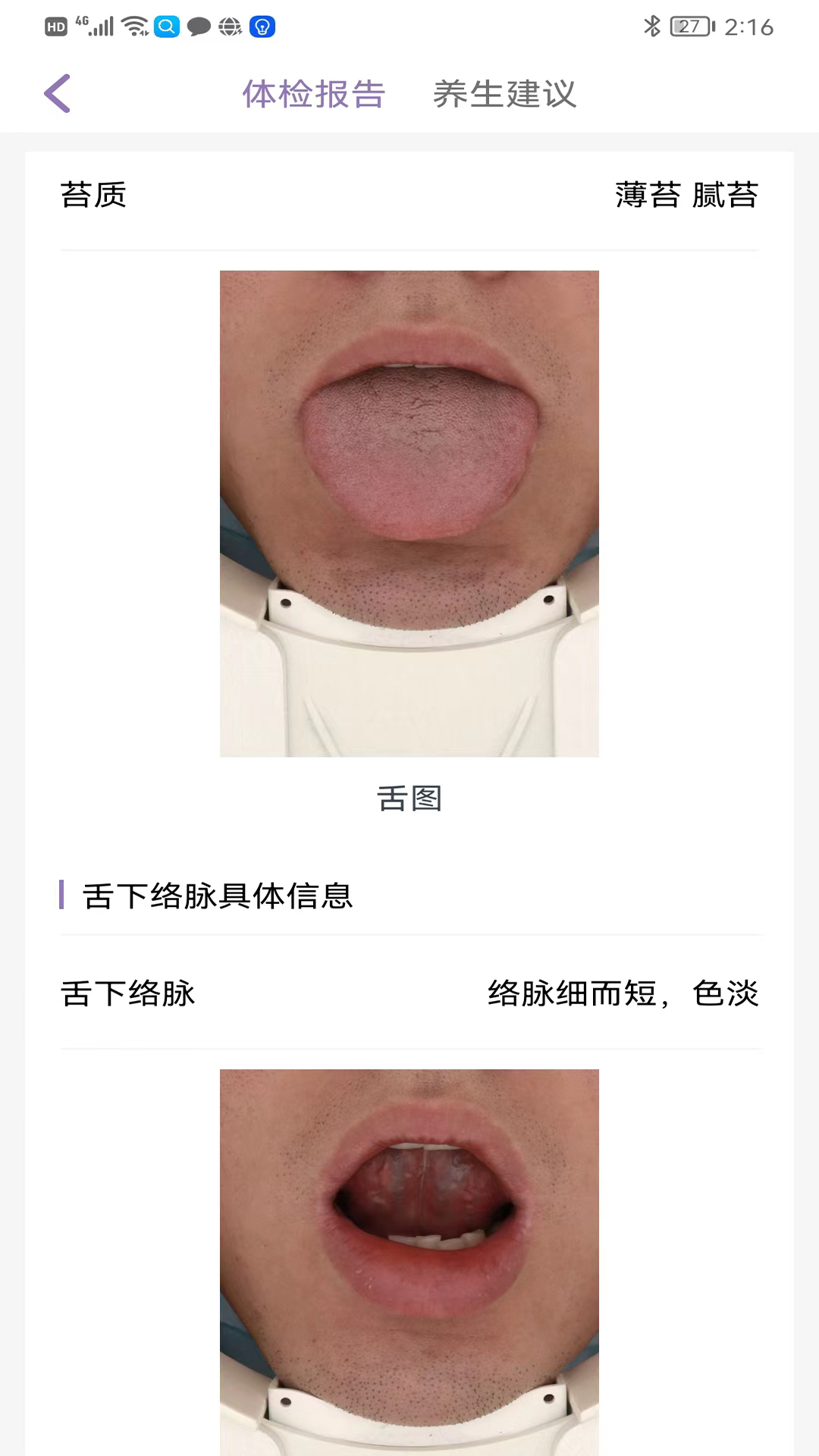 慧中医3
