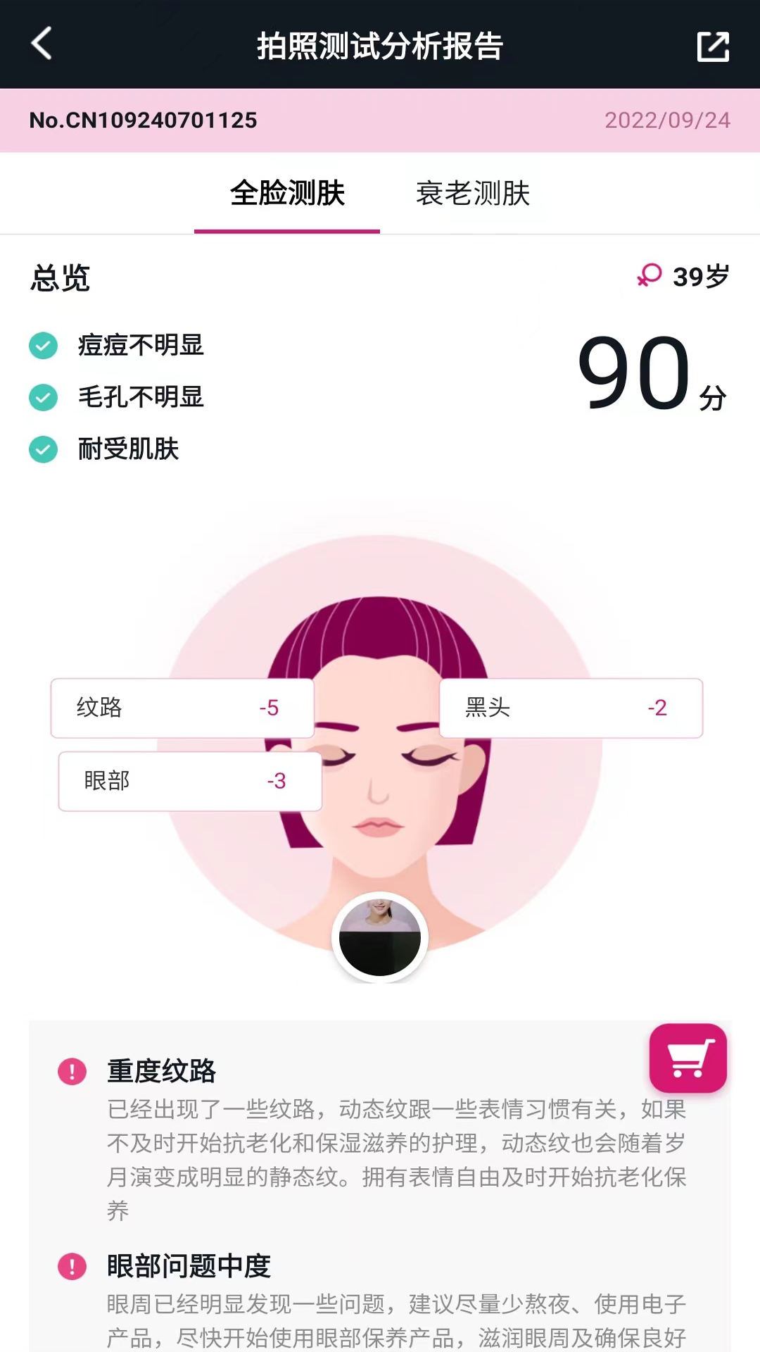 肌肤分析仪1