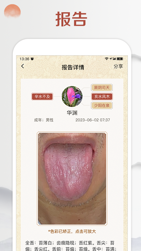 看舌头3