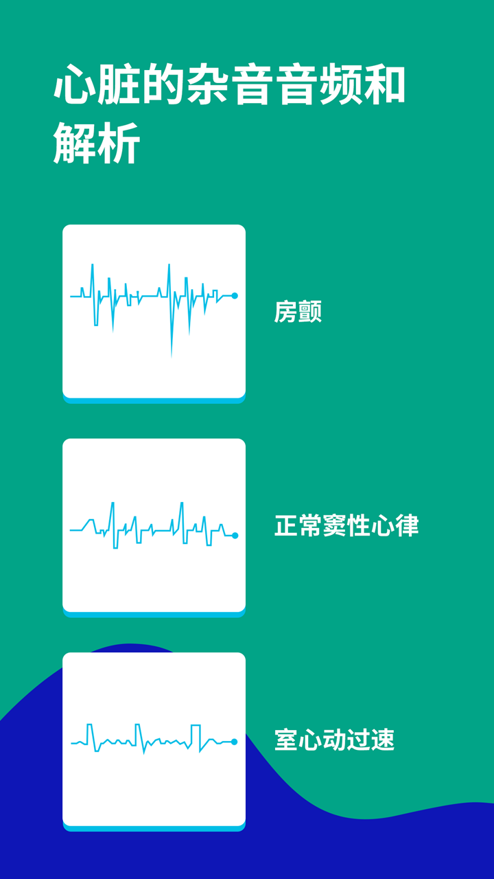 心电图ECG4