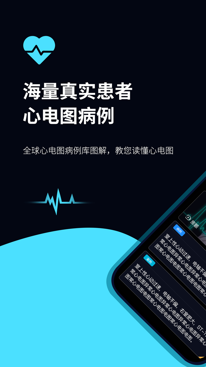 心电图ECG1