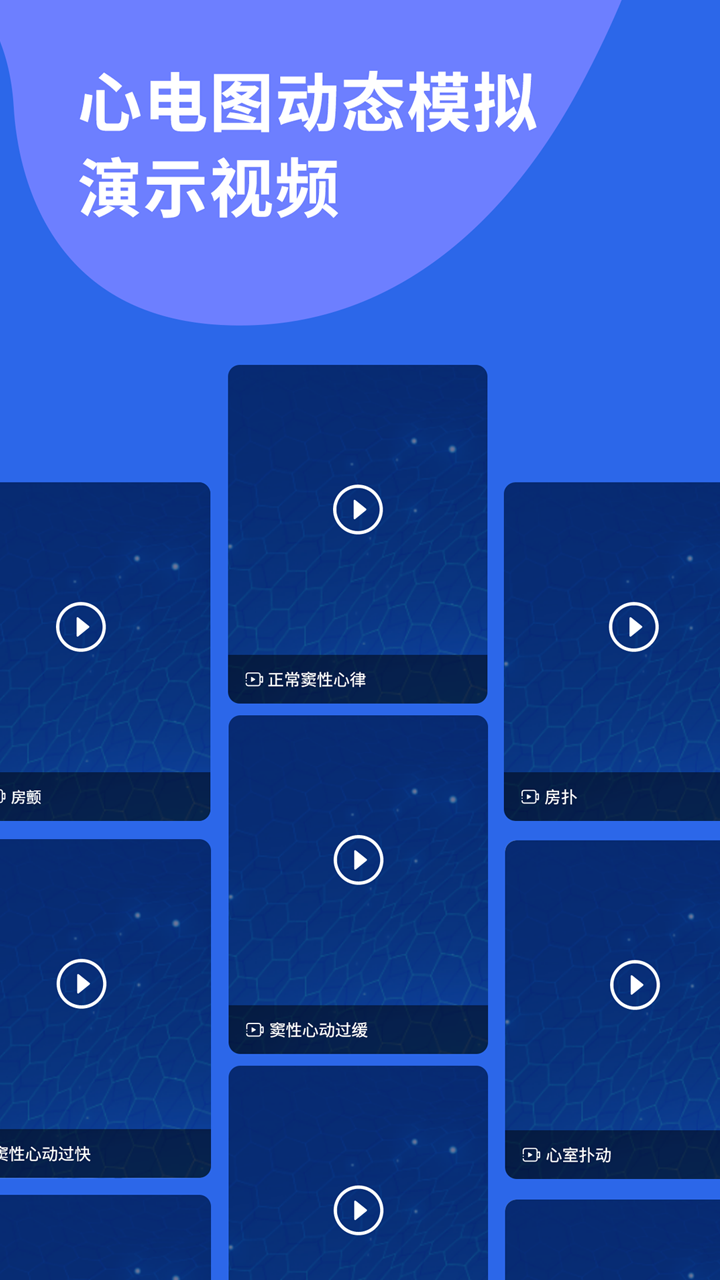 心电图ECG5